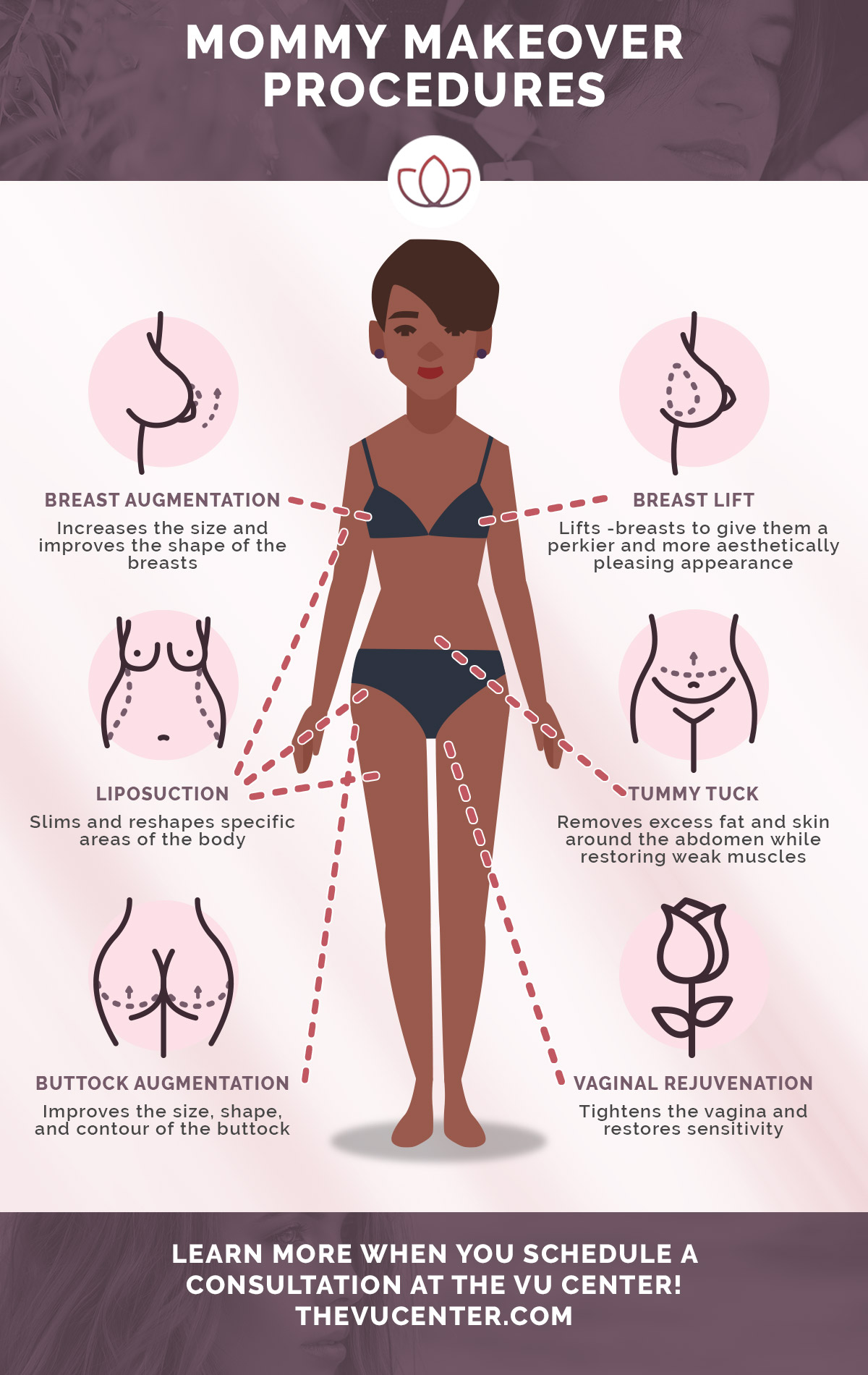 Mommy Makeover Infographic.