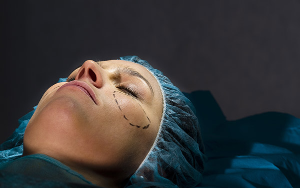 woman laying on surgical table in hair net with guide marks on her face
