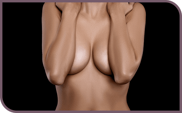 Woman after breast augmentation
