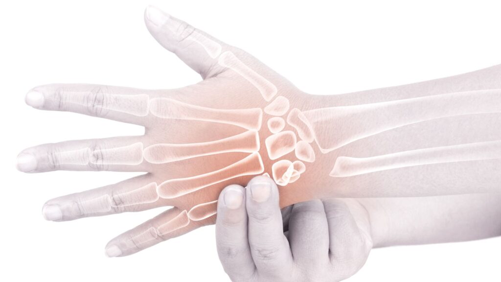 Animated drawing of bones within a hand with a person grabbing it.