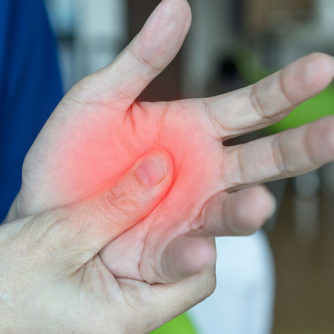 A hand with red coloring to represent pain