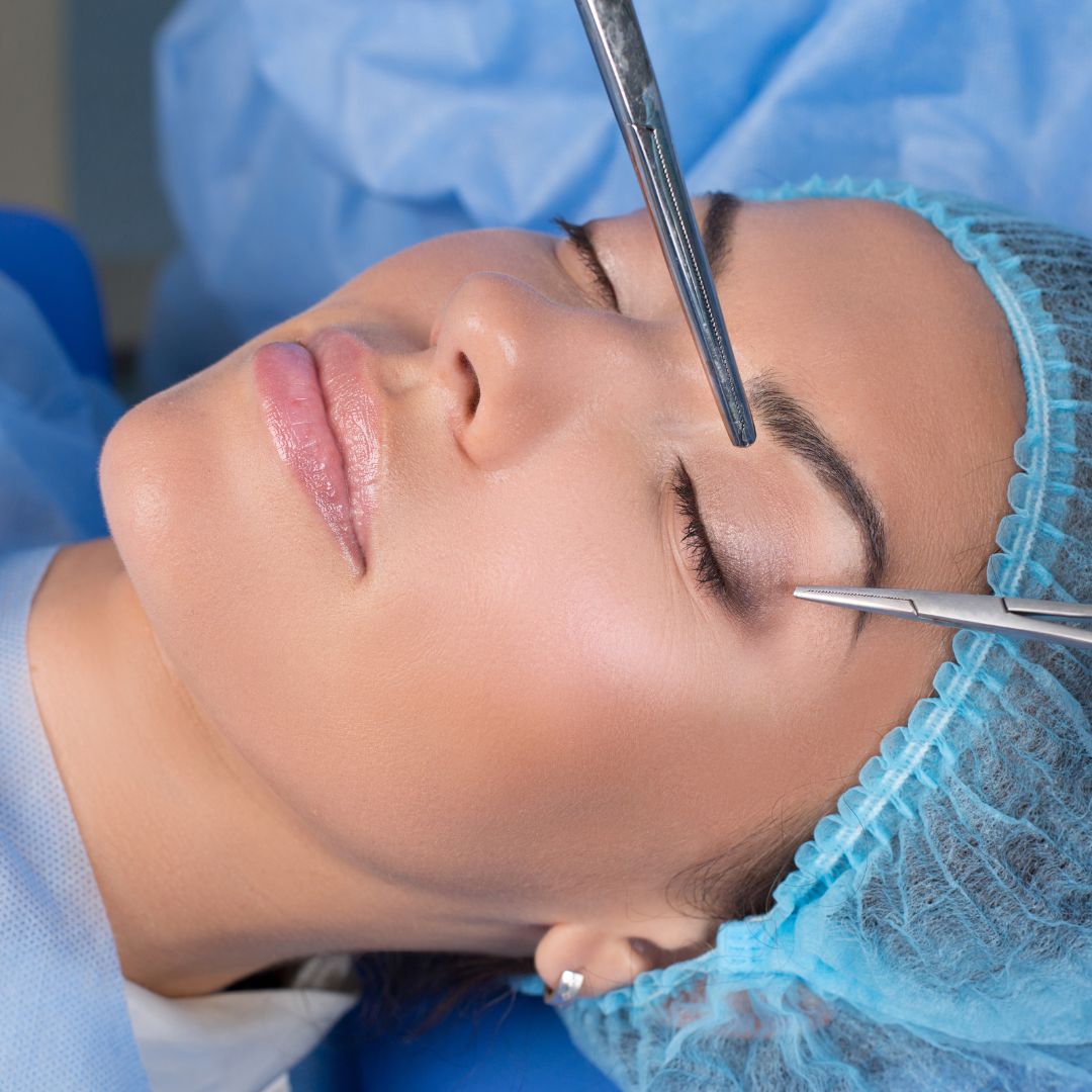 Women undergoing a brow lift