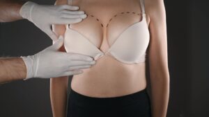 Doctor examining a women's breast