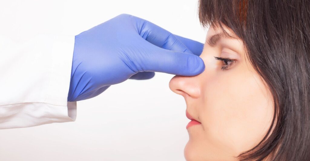 rhinoplasty consultation