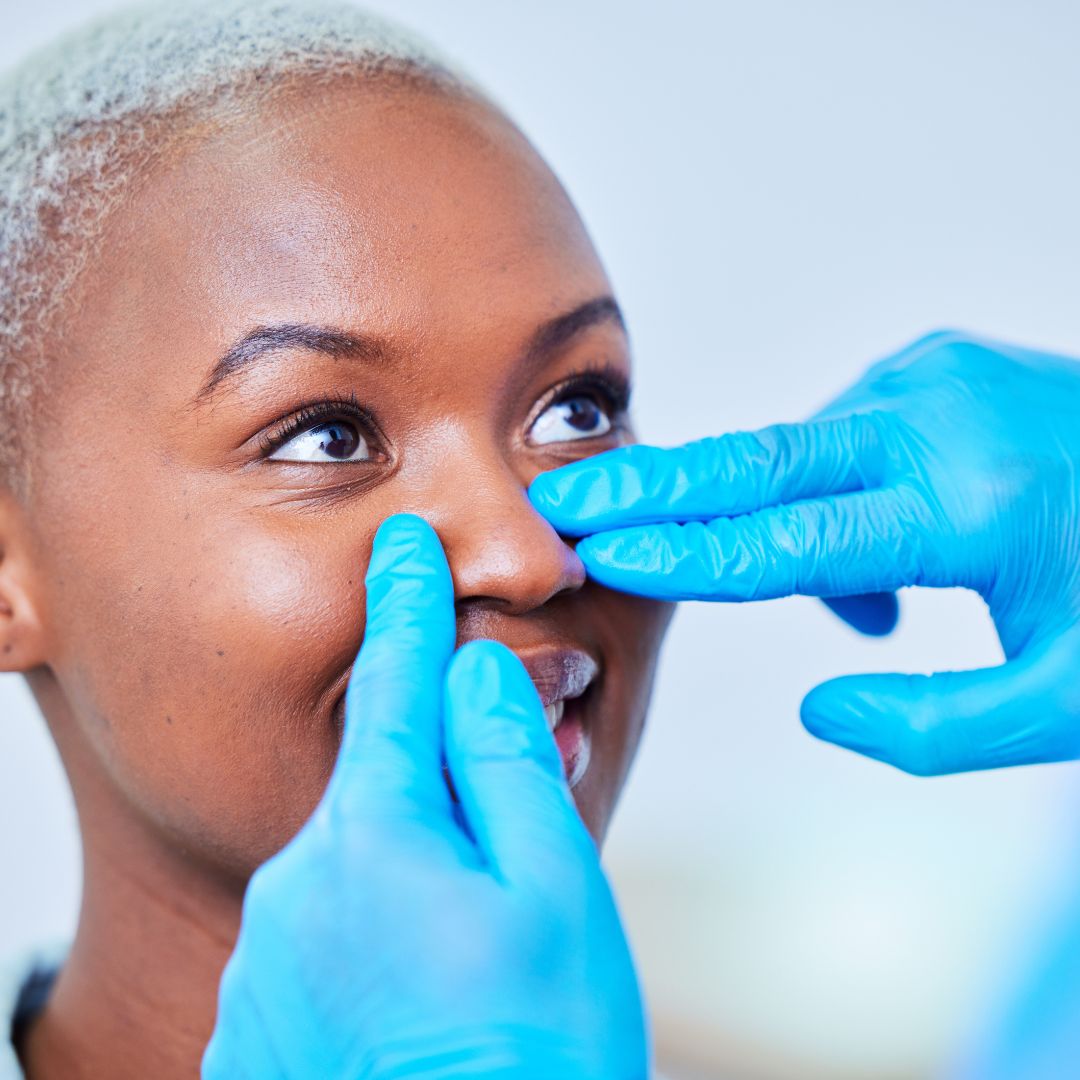 nose job consult