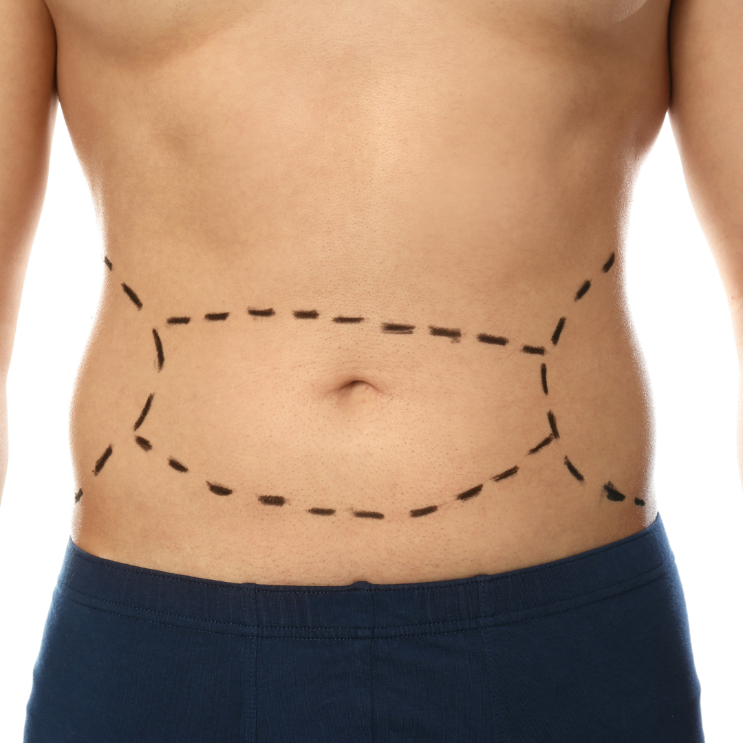 Addressing Specific Concerns 