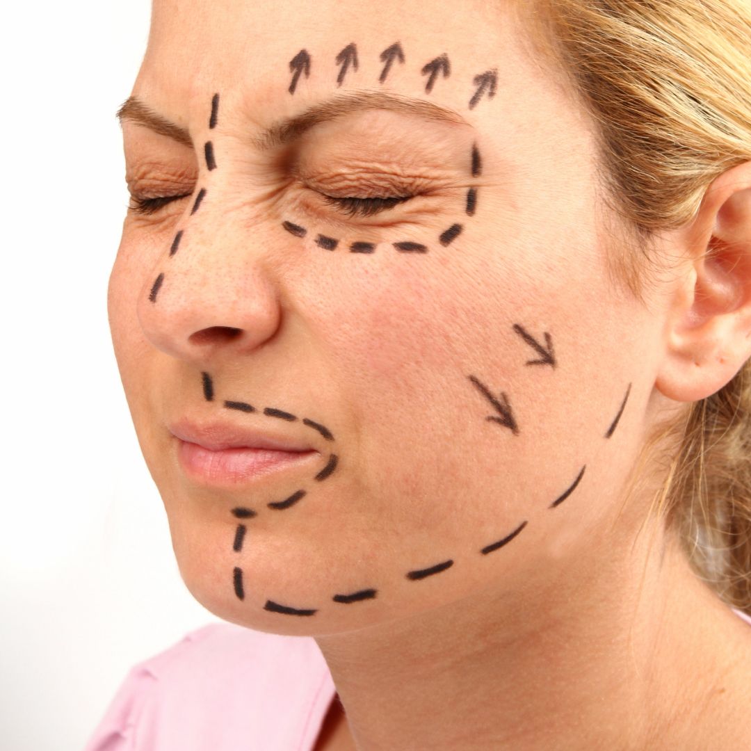 woman with pre-op markings