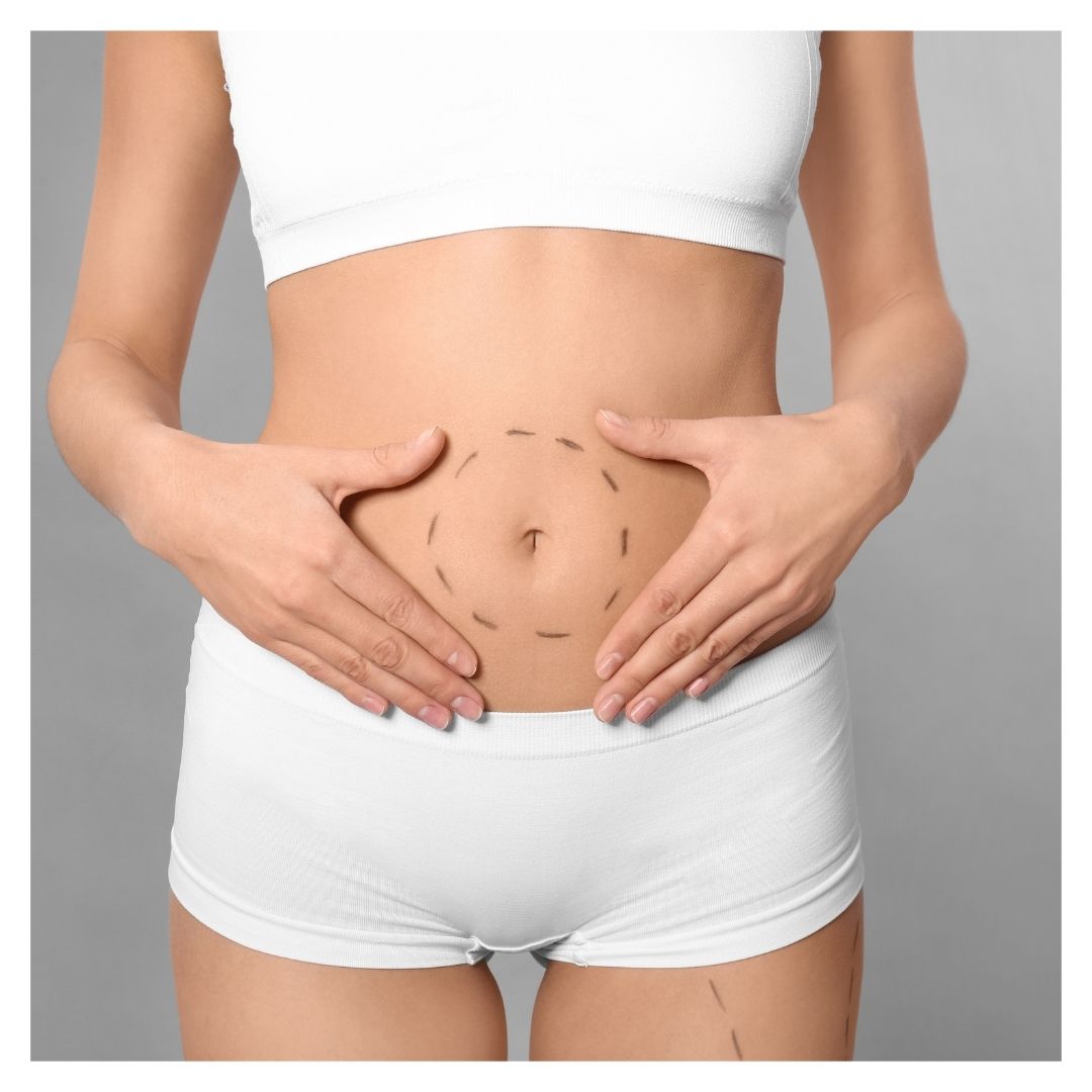 a woman holding her stomach with dotted lines around her belly button