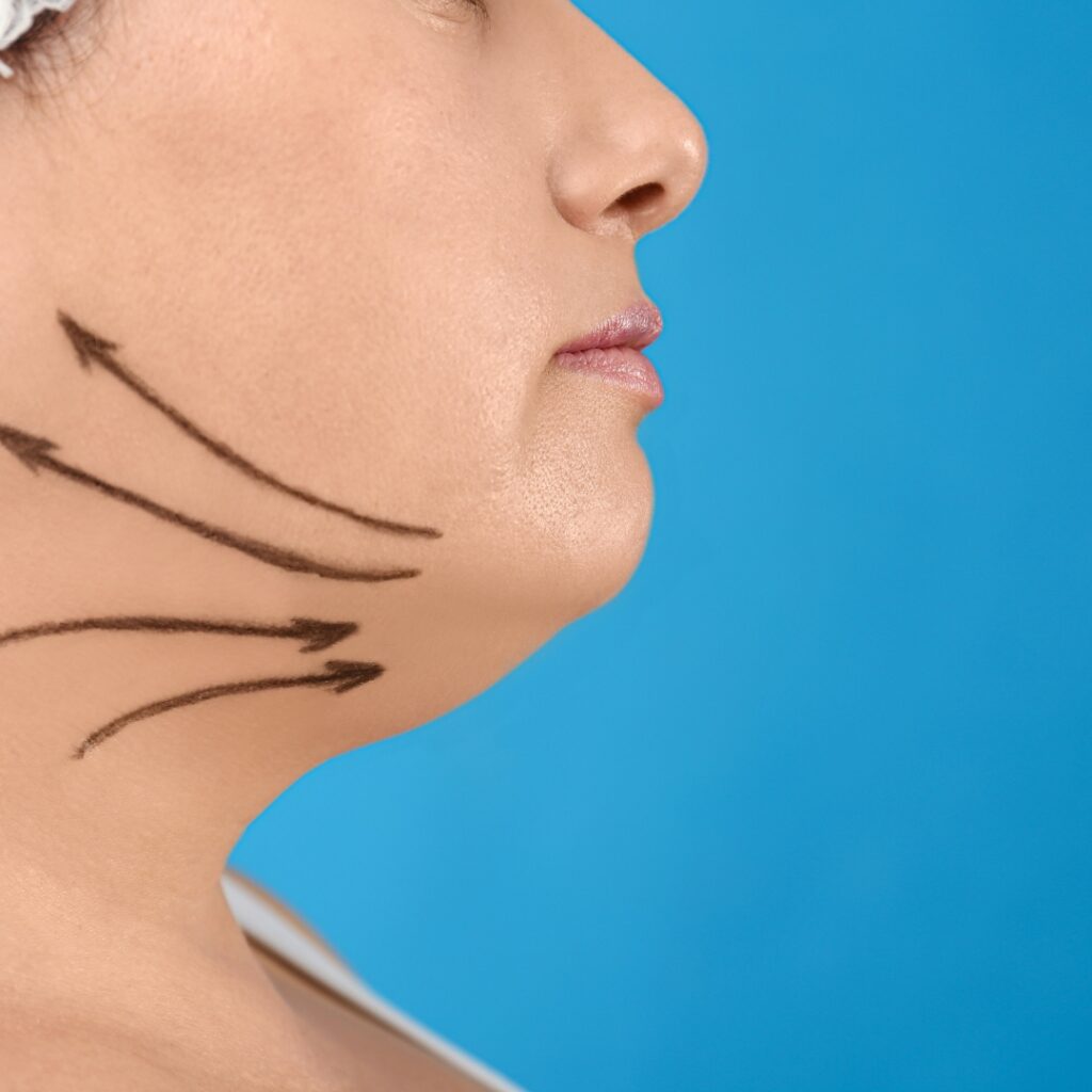woman prepping for chin surgery